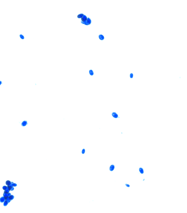 Yeast detection example